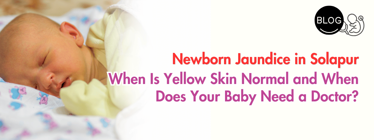 Newborn jaundice in Solapur – baby with yellow skin being examined by a neonatologist